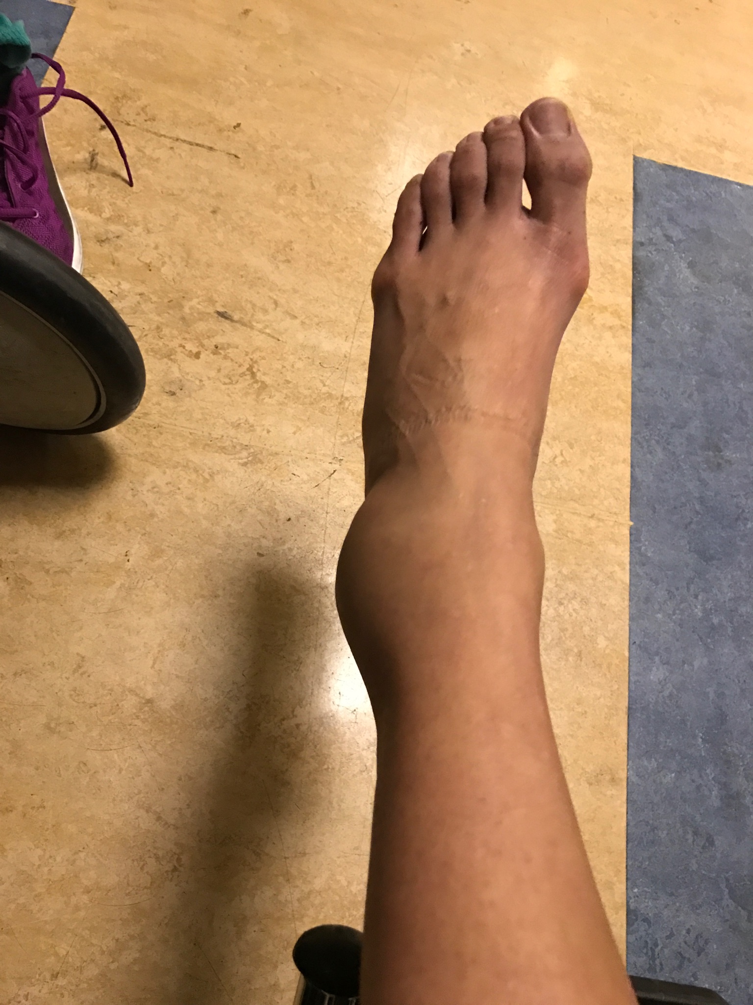 ankle-injury-spiritual-meaning